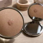Kératose visage : plaque rugueuse après UV